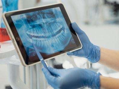 dentist holding digital x-ray | henderson nv dentist